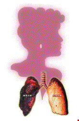 要注意 増える女性の肺腺癌 台灣光華雜誌
